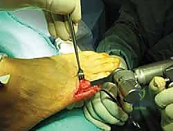 تمارين الحركة