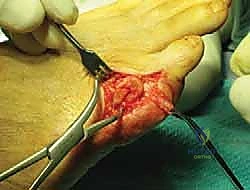 طرق العلاج التحفظي