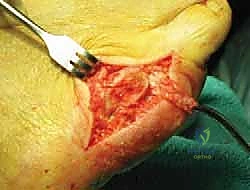 الأشعة السينية للقدم