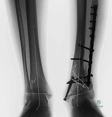 استشارات طبية مع الأستاذ الدكتور محمد هطيف