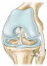 Clinical Image