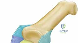 وصف طبي دقيق للمريض يوضح التشريح