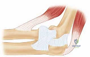 Clinical Image