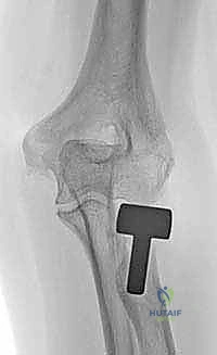 Clinical Image