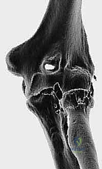 Clinical Image