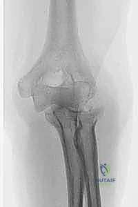 Clinical Image