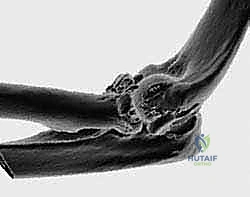 Clinical Image