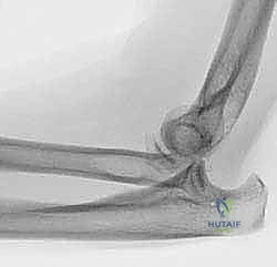 Clinical Image