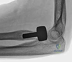 Clinical Image