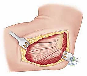 Clinical Image