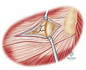 Clinical Image