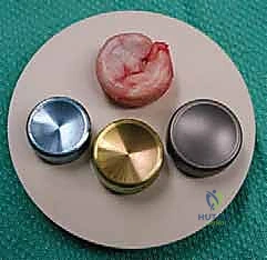 Clinical Image