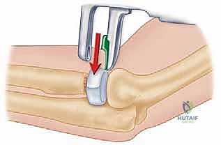 Clinical Image