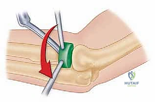 Clinical Image
