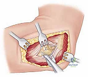 Clinical Image