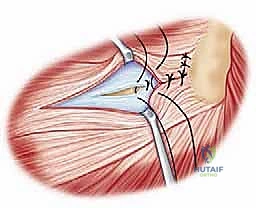 Clinical Image
