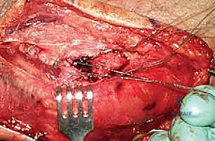 Clinical Image