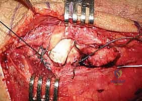 Clinical Image