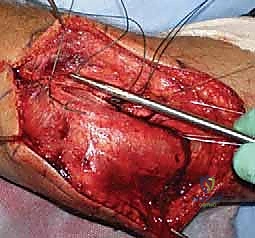 Clinical Image