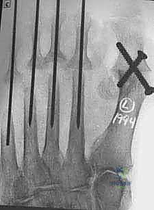 Clinical Image
