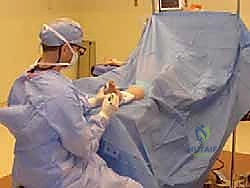 Mastering Morton's Neuroma Excision: A Comprehensive Intraoperative Guide