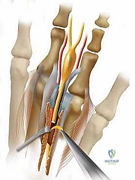 Clinical Image