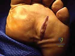 Clinical Image