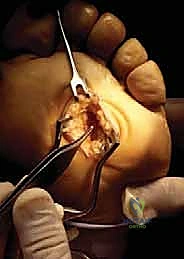 Clinical Image