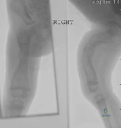 أفضل دكتور عظام في صنعاء الأستاذ الدكتور محمد هطيف