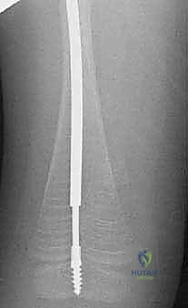 تمارين العلاج الطبيعي السلبي