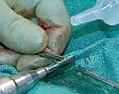 الراحة والعناية في الأسبوع الأول