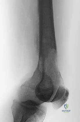 Clinical Image