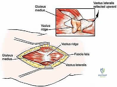 Clinical Image