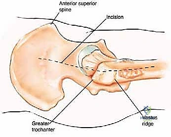 Clinical Image