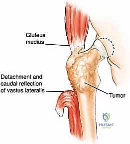 Clinical Image