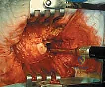 Clinical Image