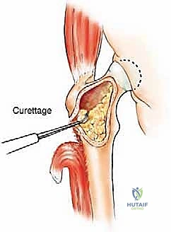 Clinical Image