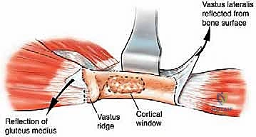 Clinical Image