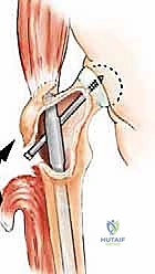 Clinical Image