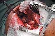 Clinical Image