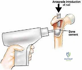Clinical Image