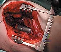 Clinical Image