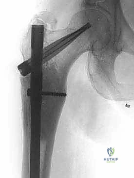 Clinical Image