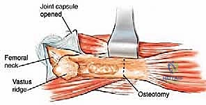 Clinical Image