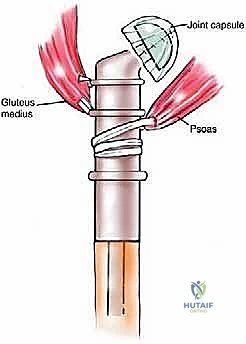 Clinical Image