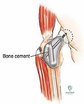 Clinical Image