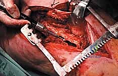 Clinical Image