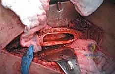 Clinical Image