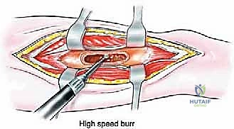 Clinical Image