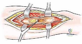 Clinical Image